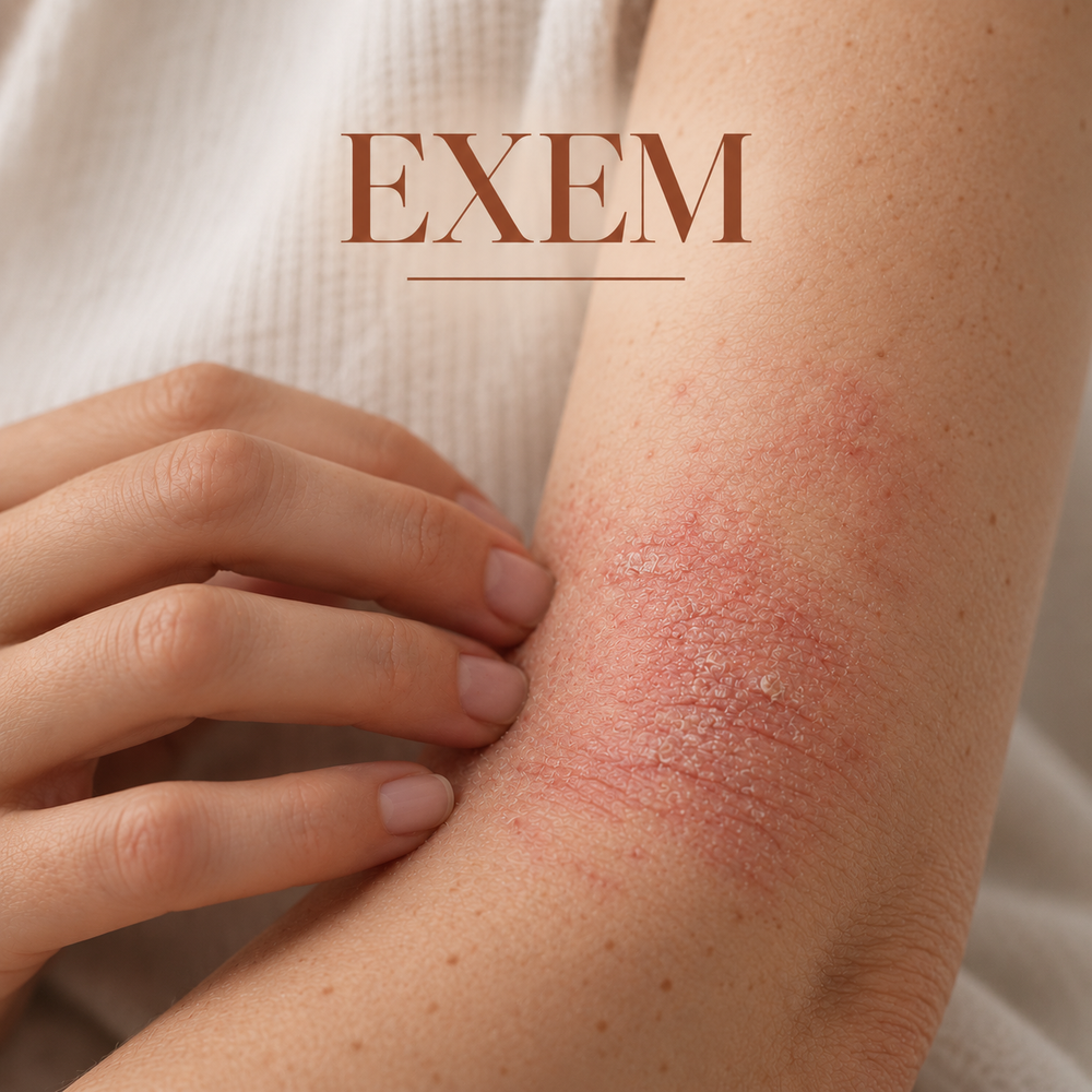 Exem húð